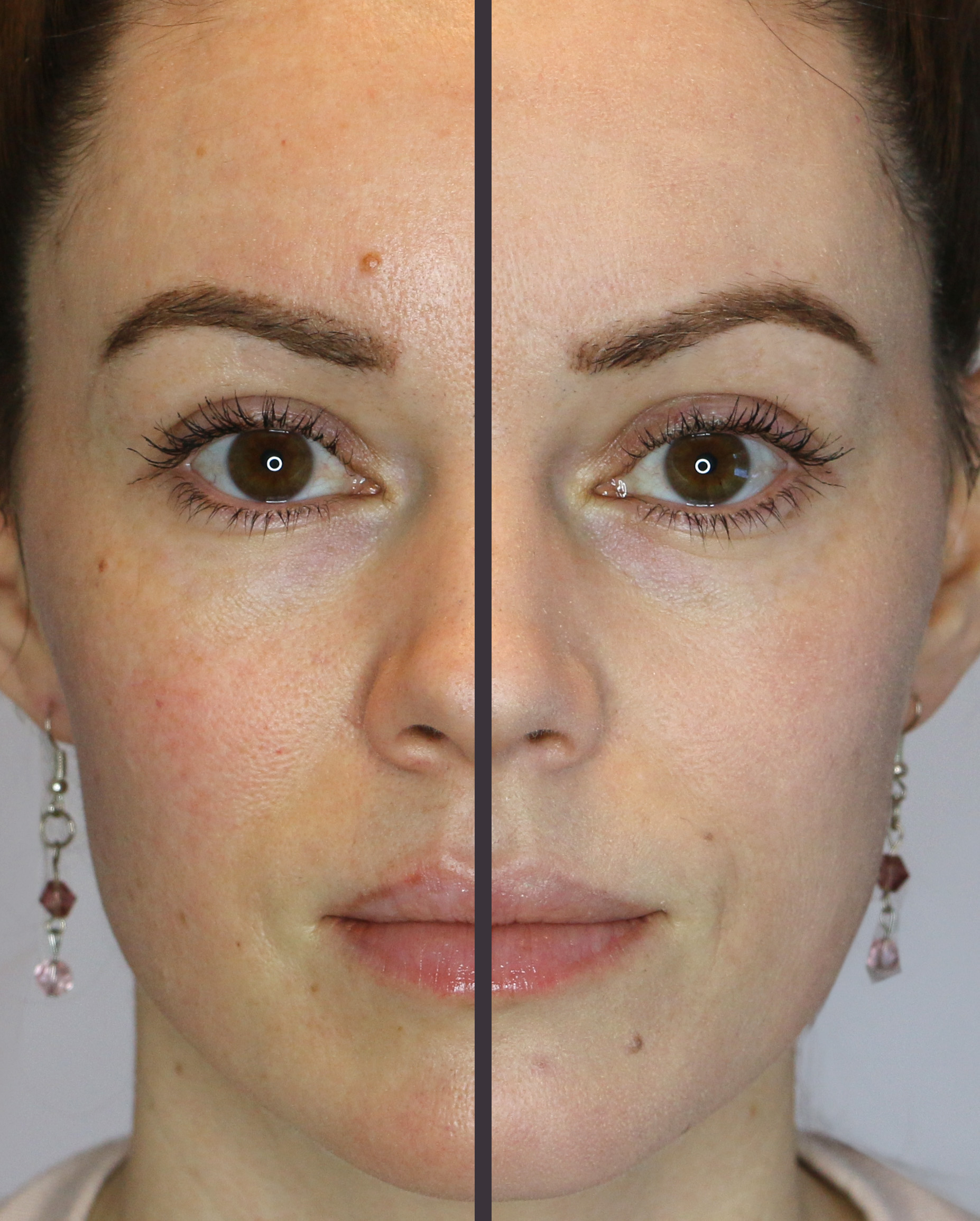 Porcelain Beige (Lightest) in Bye Bye Redness: Photos & Review | Life ...