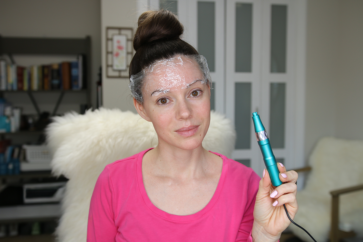 Microneedling with Dr. Pen in 2025 Microneedling with Dr. Pen in 2025