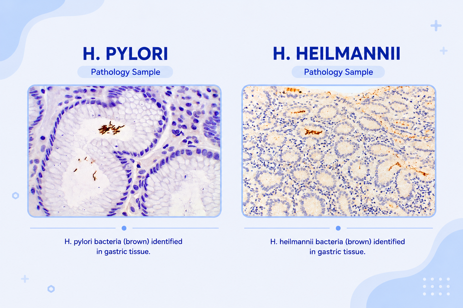 Pathology H. Heilmannii