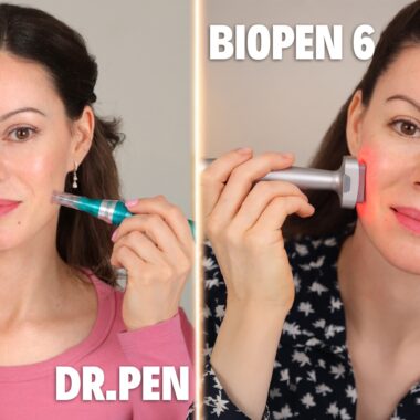 How I Microneedle at Home | Entire Process & Documentation Day by Day After Treatment